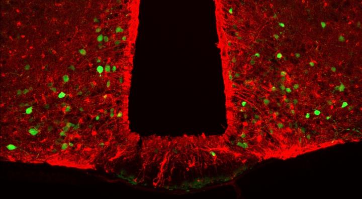 POMC Neurons and Astrocytes Expressing ACBP Protein