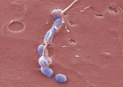 <i>Yersinia</i>