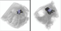 MicroCT imaging of the optic tecta (in blue) within the brain (dark) of a Peacock Flounder
