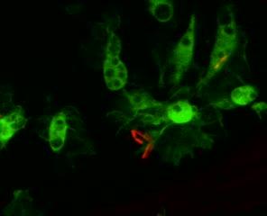 Bacteria Being Engulfed by Immune Cells