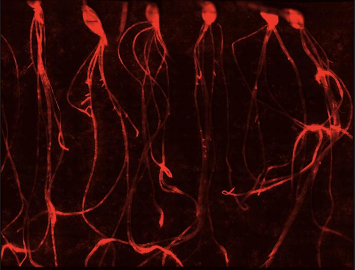 Visualisation of a root pathogen attack