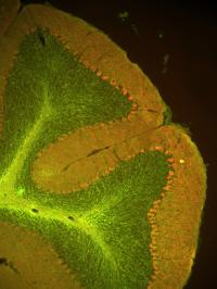 Cerebellum Neuron
