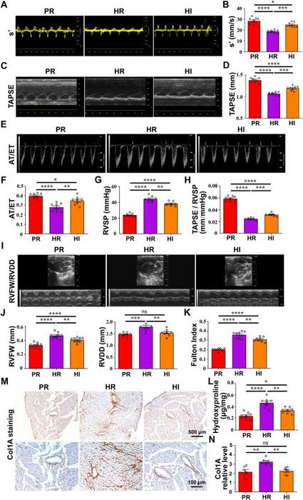 The levels of RV hypertrophy and RV dysfunction in mice subjected to normoxia or hypoxia with room light and hypoxia with intense light