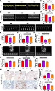 The levels of RV hypertrophy and RV dysfunction in mice subjected to normoxia or hypoxia with room light and hypoxia with intense light