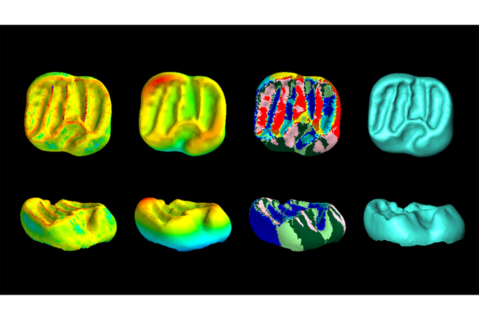 Dental CT scans