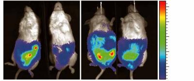 Firefly Genes Allow Testing of New Therapy Against Lymphoma 1 (of 3)
