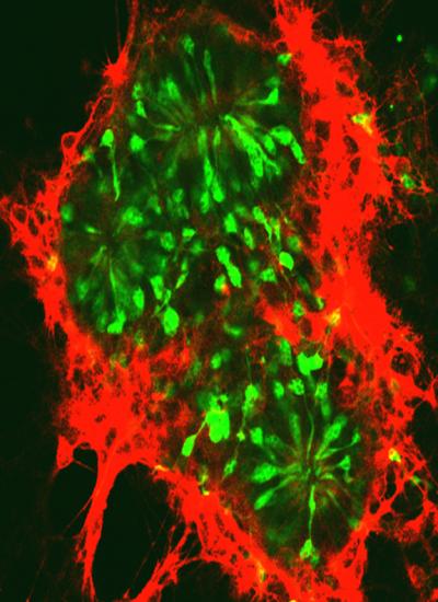 Photoreceptor Cells