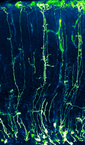 Migración neuronal