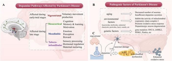 Affected brain regions and pathogenic factors of PD.