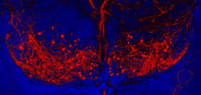 Histamine Containing Neurons in the Brain of Psen1 Mutant Zebrafish