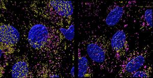 Mouse proximal tubule cell
