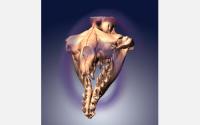 3-D Model of Asymmetrical Skull