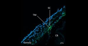 PolyU scholar discovers key mechanism of intraocular pressure regulation suggesting novel treatment approaches for glaucoma
