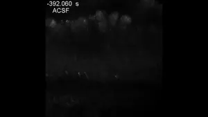 Calcium imaging of a live brain slice during clearing with SeeDB-Live