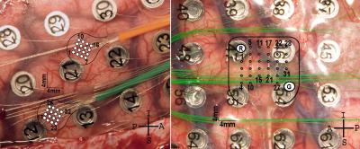 2 Kinds of Microelectrode Arrays