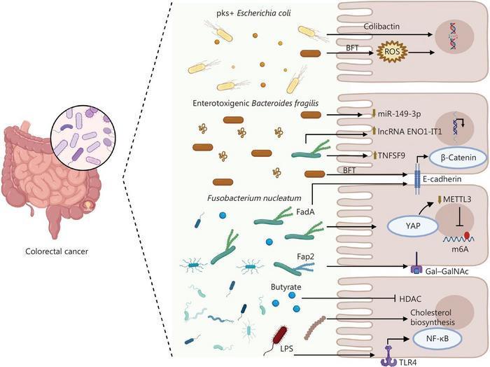 Microbiome and host interaction in CRC.