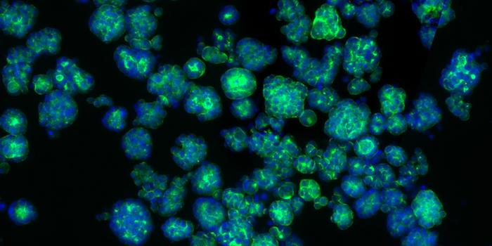 Tumor organoids