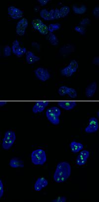Skin Cells from Patients with Roberts Syndrome