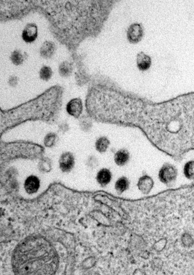 HIV-1 Viral Particles