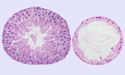 Seminiferous Tubules