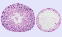 Seminiferous Tubules
