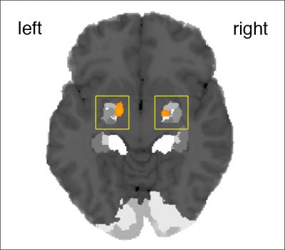 Amygdala