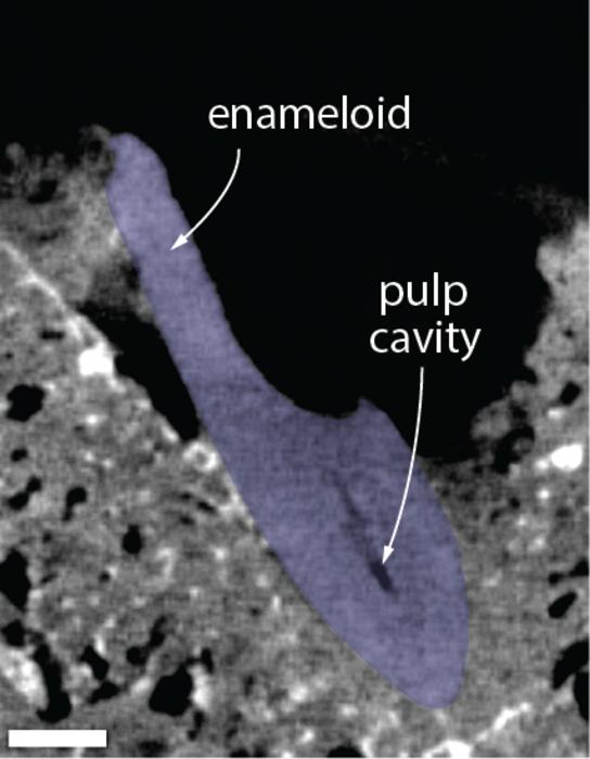 CT Scan of the embedded shark's tooth