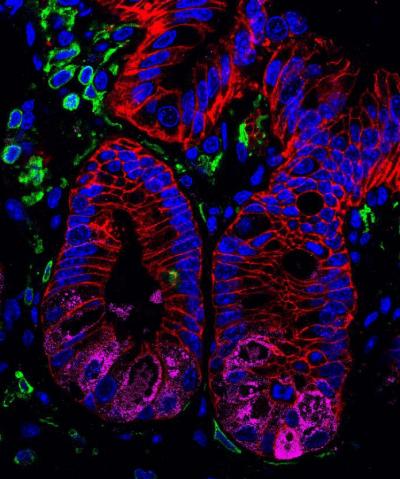 Molecular Link Between Gut Microbes and Intestinal Health