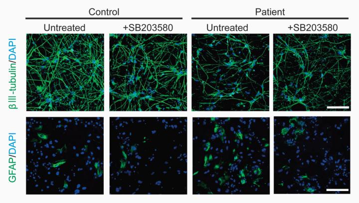 Effects of p38 Protein on Controlling Neurogenic Competence in Patient-Derived Neurospheres