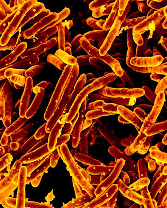 Mycobacterium tuberculosis bacteria