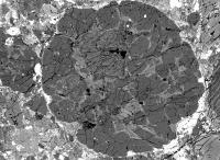 Chondrules in the Bishunpur Meteorite