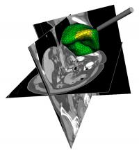 Computerized Image Analysis (2 of 2)