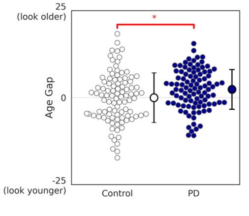 Comparison of "age gap" for patients and healthy subjects