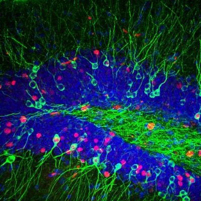 The Neuroscience of Finding Your Lost Keys