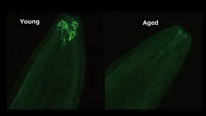 Fluorescence shows the decline in the expression of odor-detecting proteins with age in roundworms