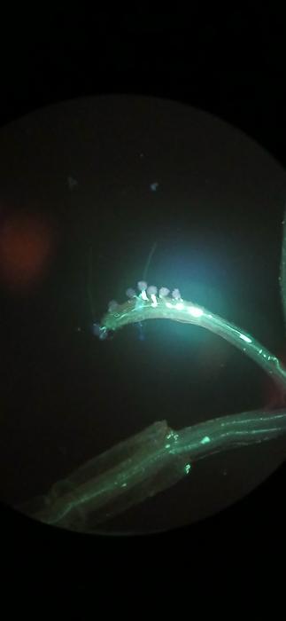 Aniline staining microscopy