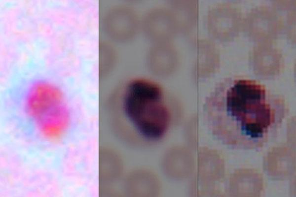 Deep Learning Transforms Smartphones into Microscopes