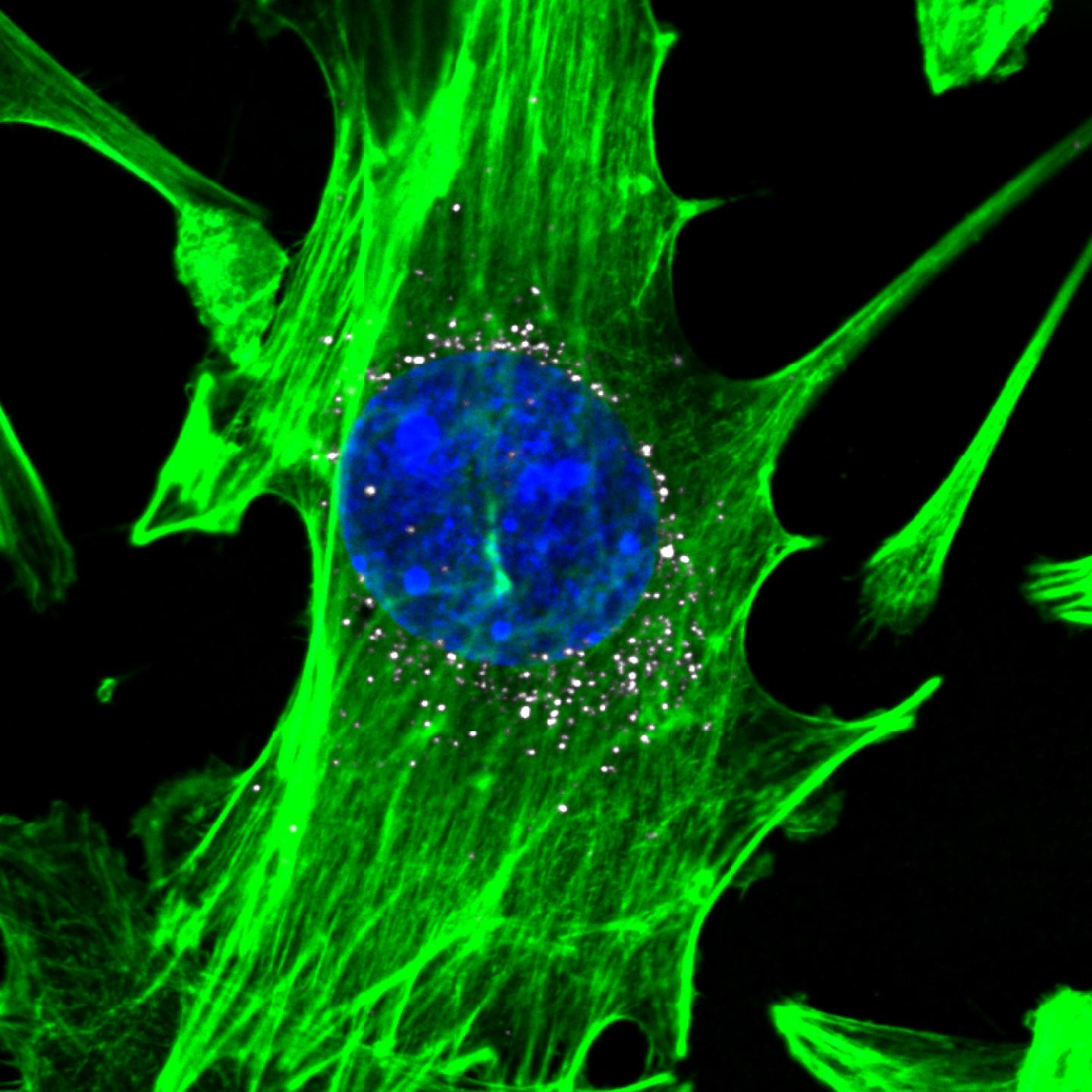 Nanoparticles in Cells