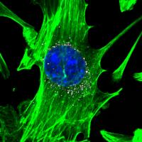 Nanoparticles in Cells