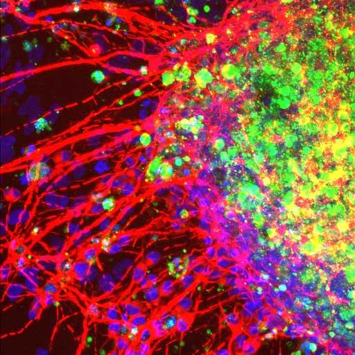 Neural Stem Cells