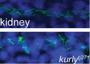 Kurly Needed for Orderly Cilia