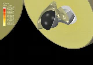 A Better Hip Implant