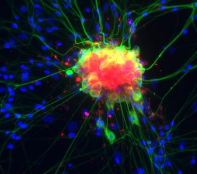 Fluorescent Immunostaining of Dorsal Root Ganglion Cells