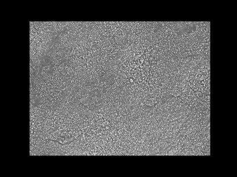 Salk Institute - Jones Lab - Cardiomyocyte Video