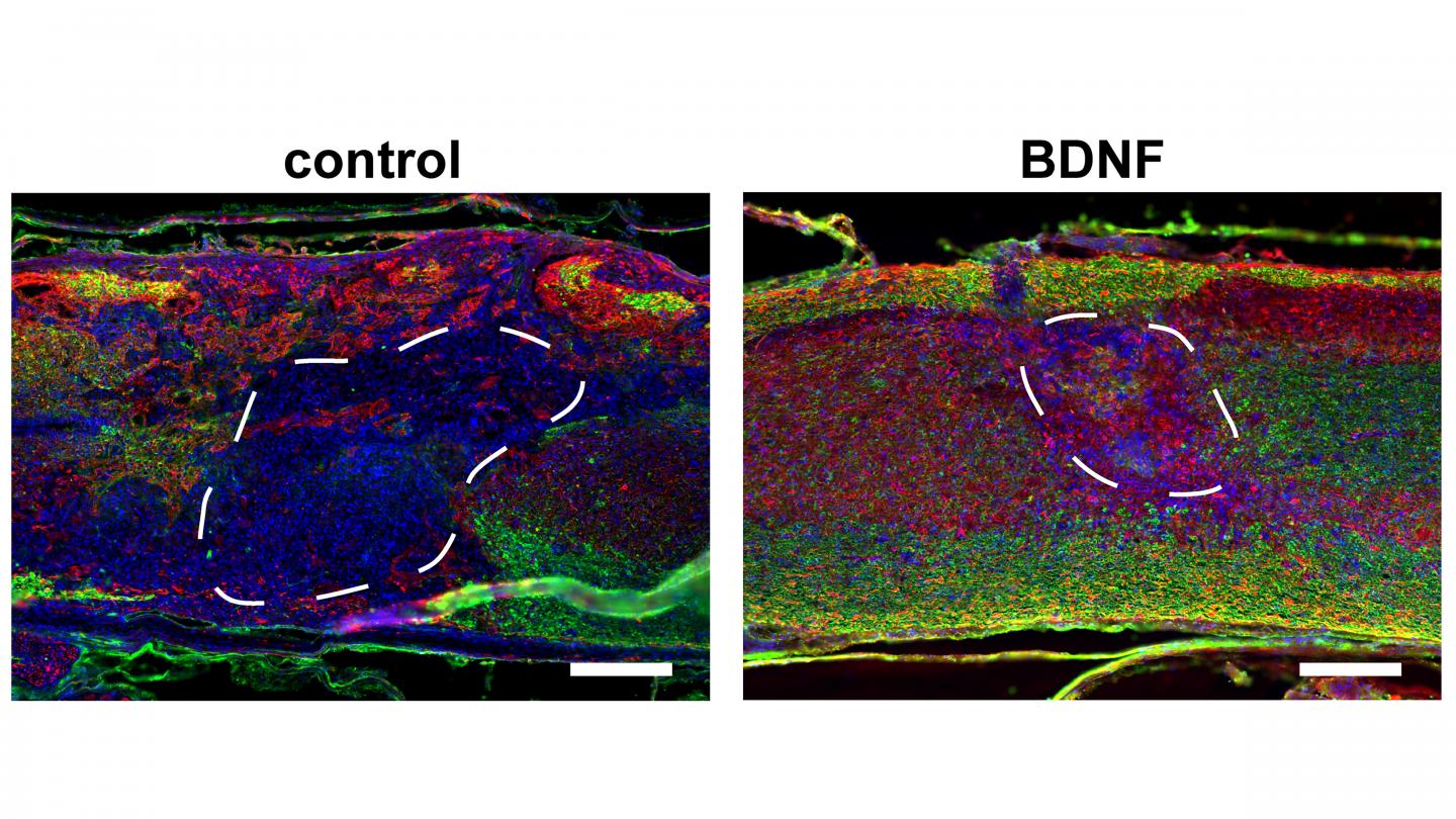 Myelinated Axons