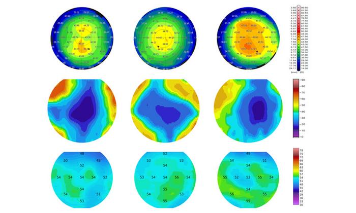 Polarization-sensitive optical coherence tomography