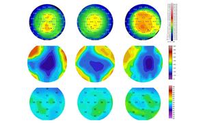 Polarization-Sensitive Optical Coherence Tomography