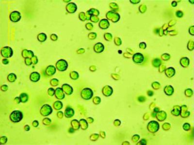 Algae