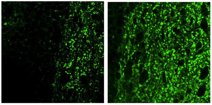 How a chemical reaction triggers brain inflammation in Alzheimer's disease