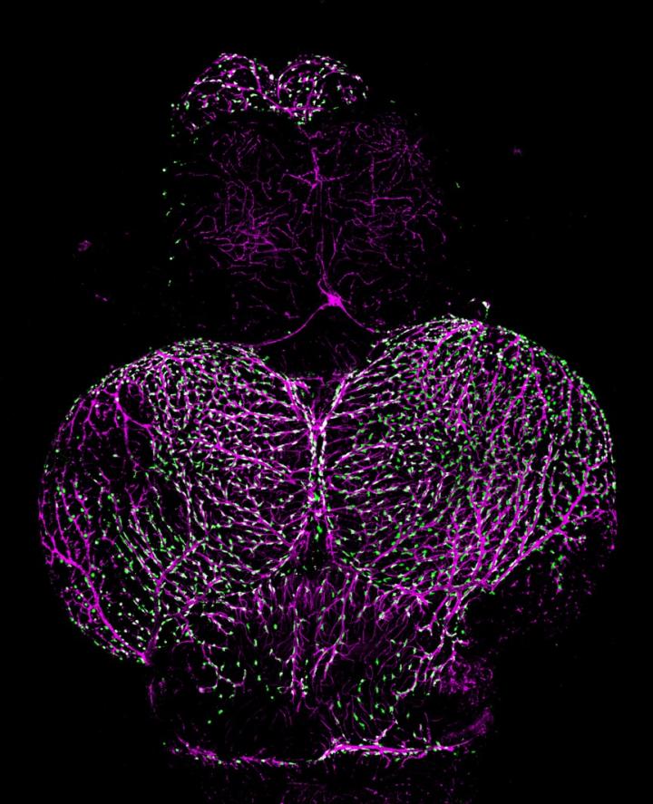 Adult Zebrafish Brain Vasculature
